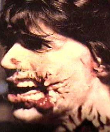 A side view of "Dead Kenny"