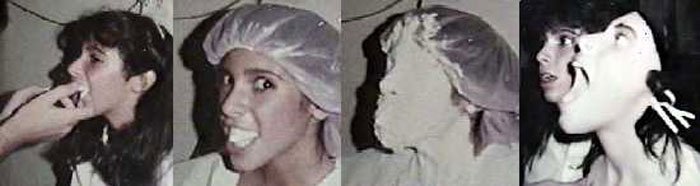 Here's a look at Felissa Rose undergoing plaster surgery!